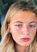 Emma Schweiger