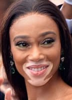 Winnie Harlow
